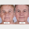 LED Light Therapy Mask Series 2