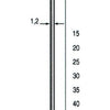 Dutack Mini brad SKN12 40 mm - 5000 Stuks